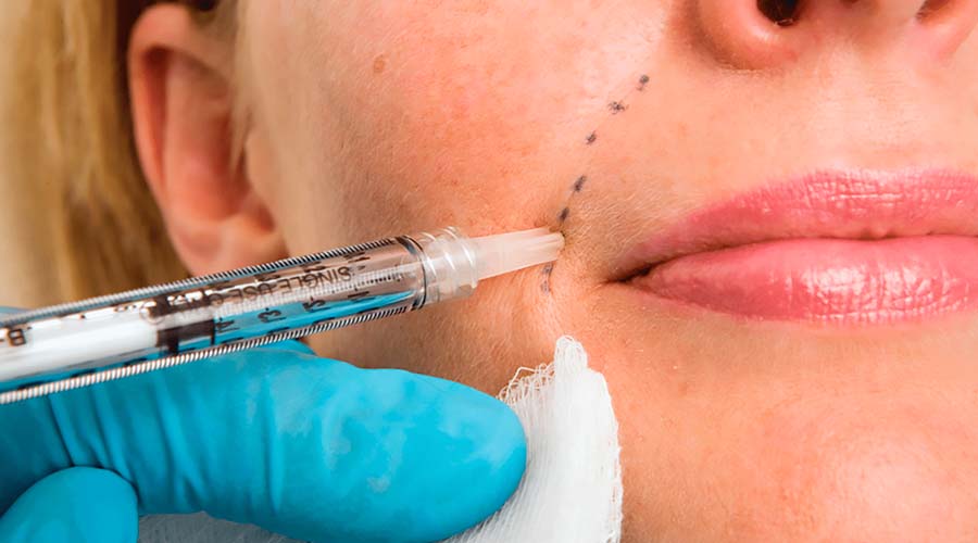 You are currently viewing Dermal Fillers Bali: A Complete Guide for First-Timers