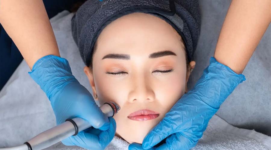 You are currently viewing A Complete Guide for First-Timers Microneedling Bali