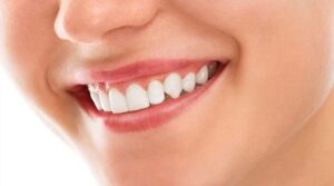 Read more about the article Smile Makeover Bali Everything First-Timers Should Know