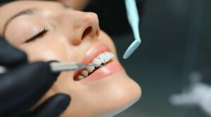 Read more about the article Dental Crowns Bali: When You Need One and How the Process Works