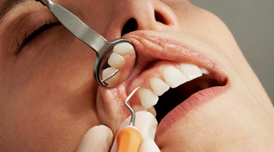 You are currently viewing Gum Disease Treatment Bali: Signs You Shouldn’t Ignore Now