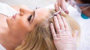 Read more about the article PRP Hair Loss Treatment Bali: Does It Really Work For You?